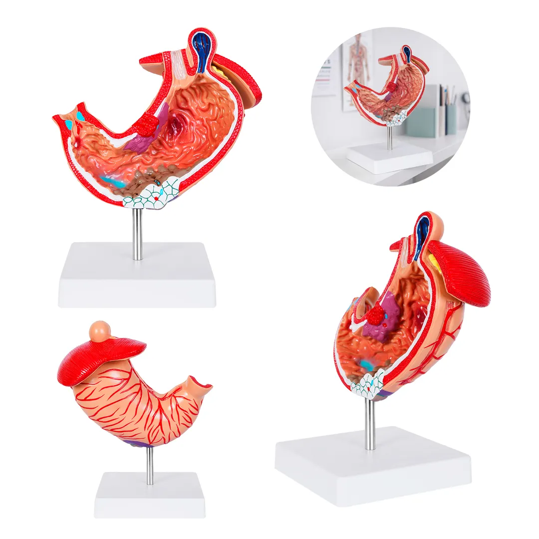 GASTRO CP 160 — clave CP 160
